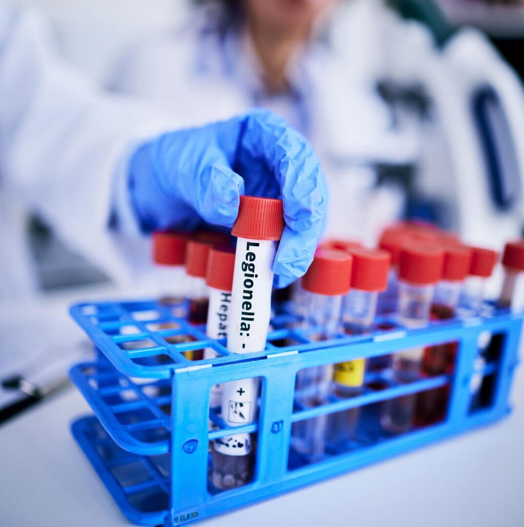 Une main gantée tient un tube à essai marqué Legionella au-dessus d'un portoir de tubes à essai bleus contenant plusieurs autres échantillons de sang dans un laboratoire.